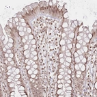Immunohistochemical staining of human rectum shows weak to moderate nuclear positivity in glandular cells.