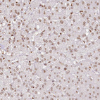 Immunohistochemical staining of human liver shows weak to moderate nuclear positivity in hepatocytes.