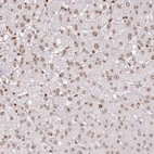 Immunohistochemical staining of human liver shows weak to moderate nuclear positivity in hepatocytes.