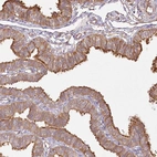 Immunohistochemical staining of human fallopian tube shows strong cytoplasmic positivity in glandular cells.
