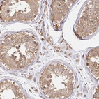 Immunohistochemical staining of human testis shows strong cytoplasmic positivity in cells in seminiferous ducts.