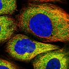 Immunofluorescent staining of human cell line A-431 shows localization to cytosol.