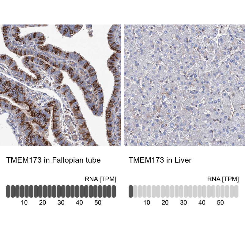 Anti-TMEM173 Antibody