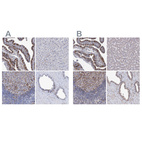 Immunohistochemical staining of human fallopian tube, liver, lymph node and prostate using Anti-TMEM173 antibody HPA038116 (A) shows similar protein distribution across tissues to independent antibody HPA038534 (B).