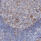 Immunohistochemical staining of human lymph node shows strong membranous positivity in follicular dendritic cells.