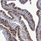 Immunohistochemical staining of human Fallopian tube shows strong cytoplasmic and membranous positivity in glandular cells.