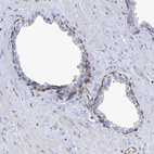 Immunohistochemical staining of human prostate shows moderate membranous positivity in basal layer glandular cells.