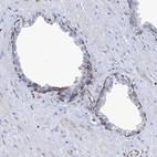 Immunohistochemical staining of human prostate shows moderate membranous positivity in basal layer glandular cells.