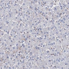 Immunohistochemical staining of human liver shows no positivity in hepatocytes as expected.