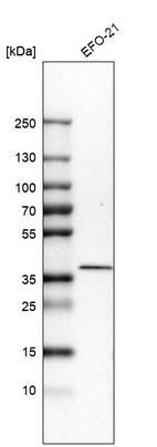 Western blot analysis in human cell line EFO-21.