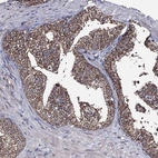 Immunohistochemical staining of human prostate shows high expression.