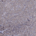 Anti-CREB3L4 Antibody