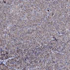 Immunohistochemical staining of human pancreas shows low expression as expected.