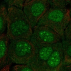 Anti-C10orf67 Antibody