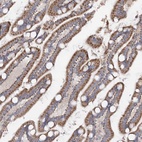 Anti-TMEM187 Antibody