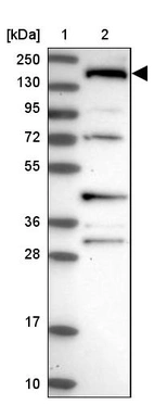 Lane 1: Marker [kDa] 250, 130, 95, 72, 55, 36, 28, 17, 10_br/_Lane 2: Human cell line RT-4