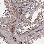 Anti-GAL3ST4 Antibody