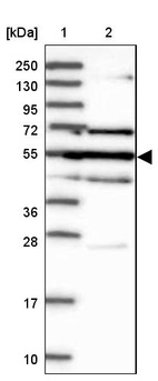 Lane 1: Marker [kDa] 250, 130, 95, 72, 55, 36, 28, 17, 10_br/_Lane 2: Human cell line RT-4