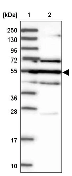 Lane 1: Marker [kDa] 250, 130, 95, 72, 55, 36, 28, 17, 10_br/_Lane 2: Human cell line RT-4