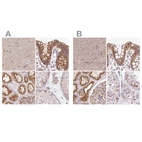 Anti-HIP1R Antibody