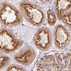 Immunohistochemical staining of human kidney using Anti-HIP1R antibody HPA038136.