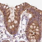 Immunohistochemical staining of human colon using Anti-HIP1R antibody HPA038136.