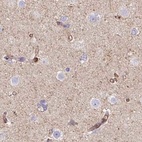 Immunohistochemical staining of human cerebral cortex using Anti-HIP1R antibody HPA038136.
