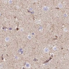 Immunohistochemical staining of human cerebral cortex using Anti-HIP1R antibody HPA038136.
