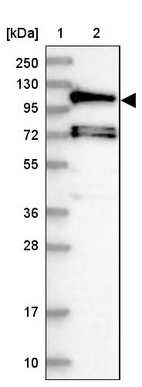 Lane 1: Marker [kDa] 250, 130, 95, 72, 55, 36, 28, 17, 10_br/_Lane 2: Human cell line RT-4
