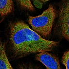 Immunofluorescent staining of human cell line U-2 OS shows localization to cytosol.