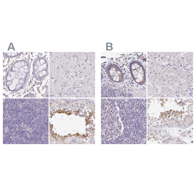 Anti-PLCD4 Antibody