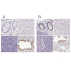 Anti-PLCD4 Antibody