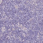 Anti-PLCD4 Antibody