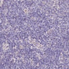 Immunohistochemical staining of human lymph node using Anti-PLCD4 antibody HPA038140.