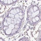 Immunohistochemical staining of human colon using Anti-PLCD4 antibody HPA038140.