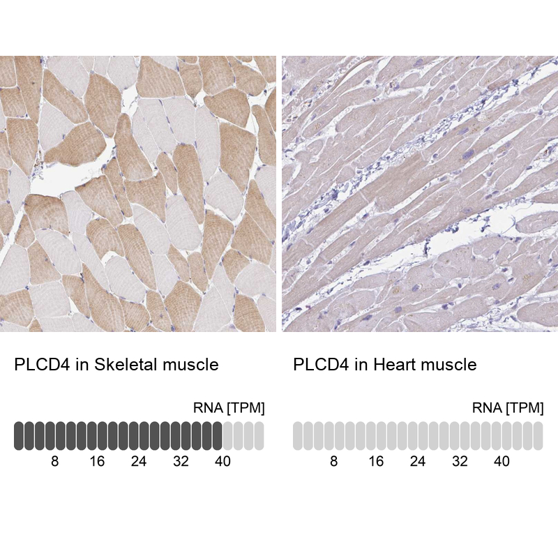 Anti-PLCD4 Antibody