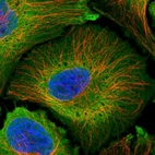 Immunofluorescent staining of human cell line HeLa shows localization to plasma membrane & cytosol.