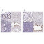 Immunohistochemical staining of human colon, liver, lymph node and testis using Anti-PLCD4 antibody HPA038139 (A) shows similar protein distribution across tissues to independent antibody HPA038140 (B).