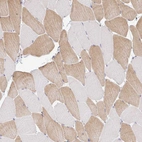 Immunohistochemical staining of human skeletal muscle shows high expression.