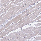Immunohistochemical staining of human heart muscle shows low expression as expected.