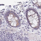 Immunohistochemical staining of human colon using Anti-PLCD4 antibody HPA038139.