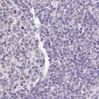 Immunohistochemical staining of human lymph node using Anti-PLCD4 antibody HPA038139.