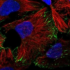 Immunofluorescent staining of human cell line U-2 OS shows localization to plasma membrane & focal adhesion sites.