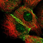 Immunofluorescent staining of human cell line A-431 shows localization to nucleoli & vesicles.