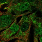 Immunofluorescent staining of human cell line SK-MEL-30 shows localization to nucleoplasm, plasma membrane & mitochondria.