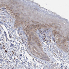 Anti-GJB5 Antibody