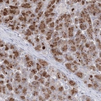 Immunohistochemical staining of human pancreas shows strong cytoplasmic positivity in exocrine glandular cells.