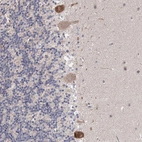Immunohistochemical staining of human cerebellum shows moderate cytoplasmic positivity in Purkinje cells.