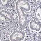 Immunohistochemical staining of human endometrium shows negative positivity in glandular cells.