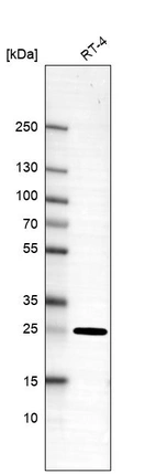 Western blot analysis in human cell line RT-4.